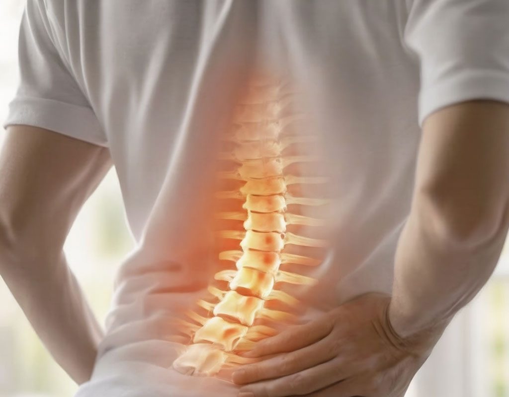Visual representation of inflammation in the lumbar spine associated with lower back pain